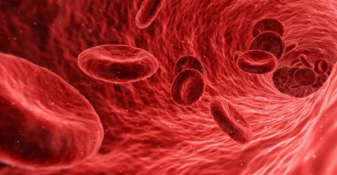 Anemia por deficiencia de hierro – Causas, dietas y tratamientos